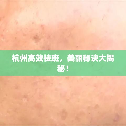 杭州高效祛斑，美麗秘訣大揭秘！