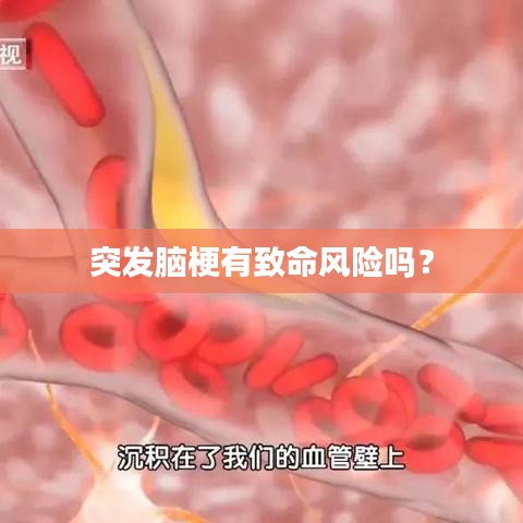 突發(fā)腦梗有致命風(fēng)險(xiǎn)嗎？